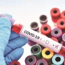RT-PCR testing for COVID-19 in Visakhapatnam after first 2025 case reported